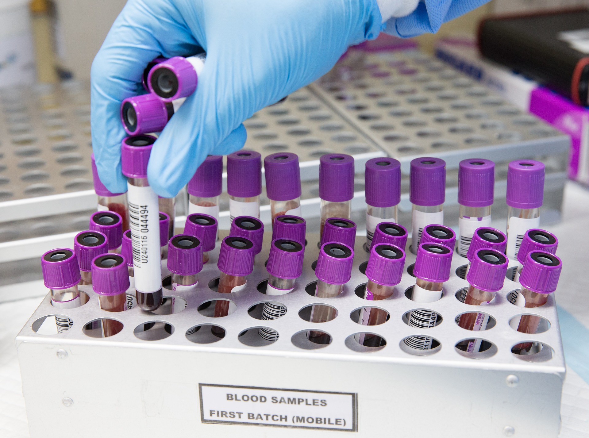 Tecnología avanzada para diagnósticos precisos en Laboratorio Clínico Altos de Jalisco